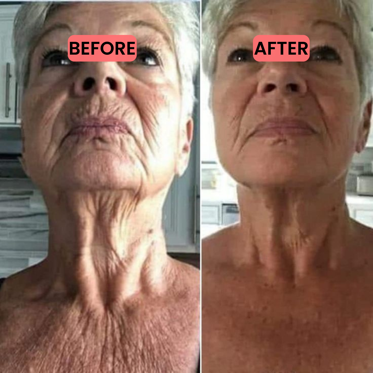 HEALVX™ Vitamin Super Serum C