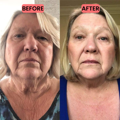 HEALVX™ Vitamin Super Serum C