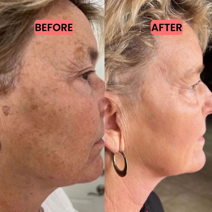 HEALVX™ Vitamin Super Serum C